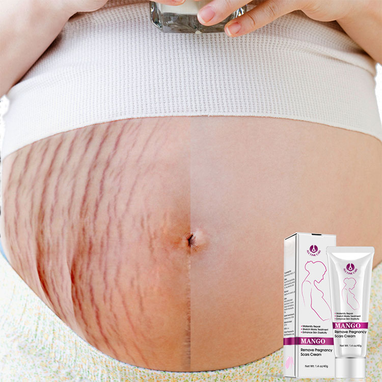 Pregnancy cream