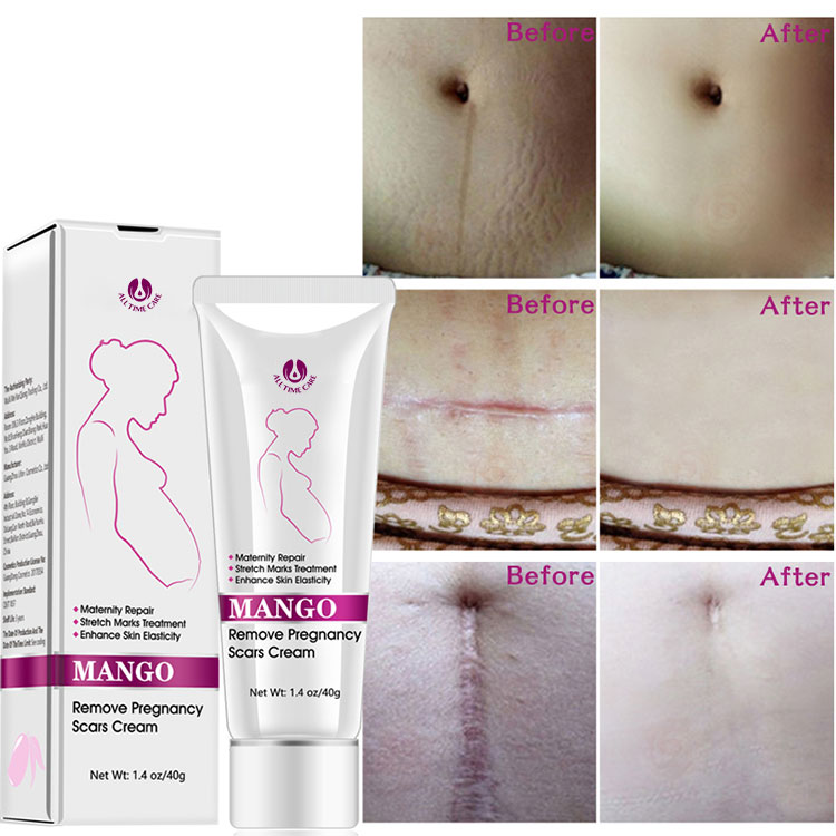 Repair whitening cream