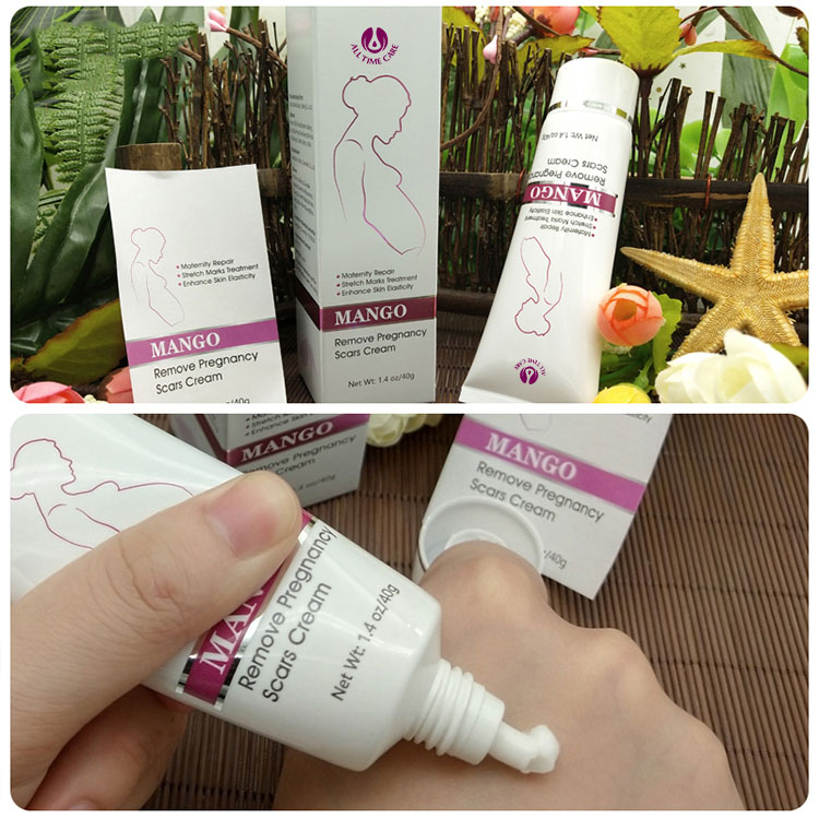 Stretch Mark Repair Cream