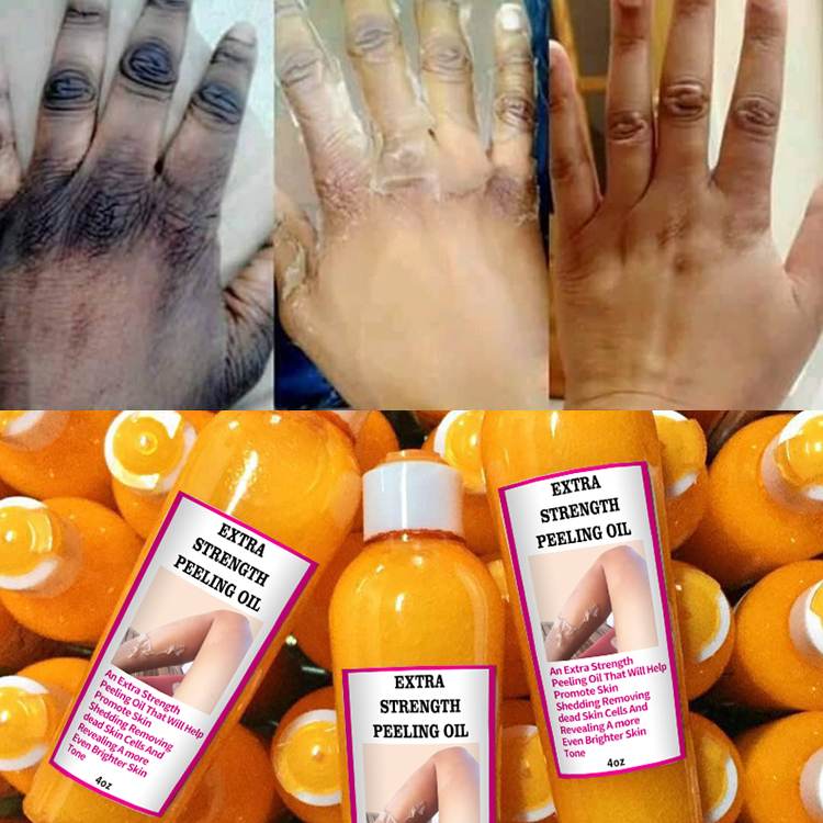 peel lotion manufacturer