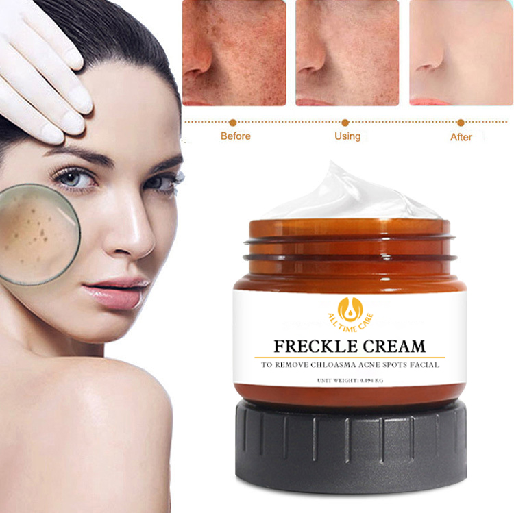freckle cream China factory