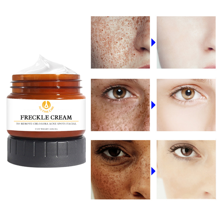 freckle cream bulk