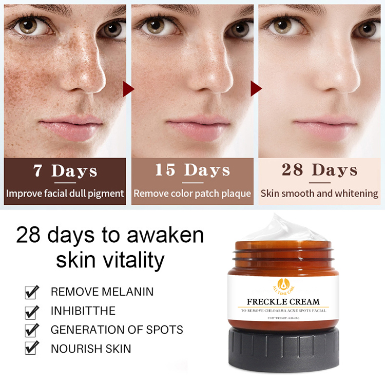 freckle cream wholesaler
