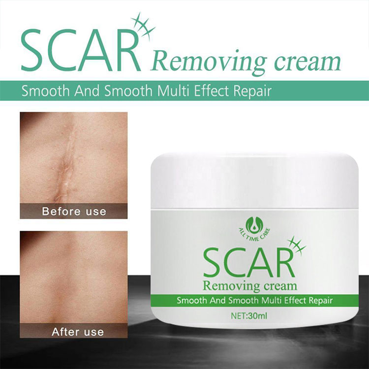 Scar Removing Cream ALLTIMECARE