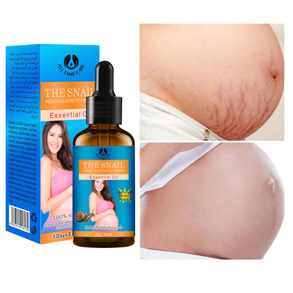 Stretch mark repair oil